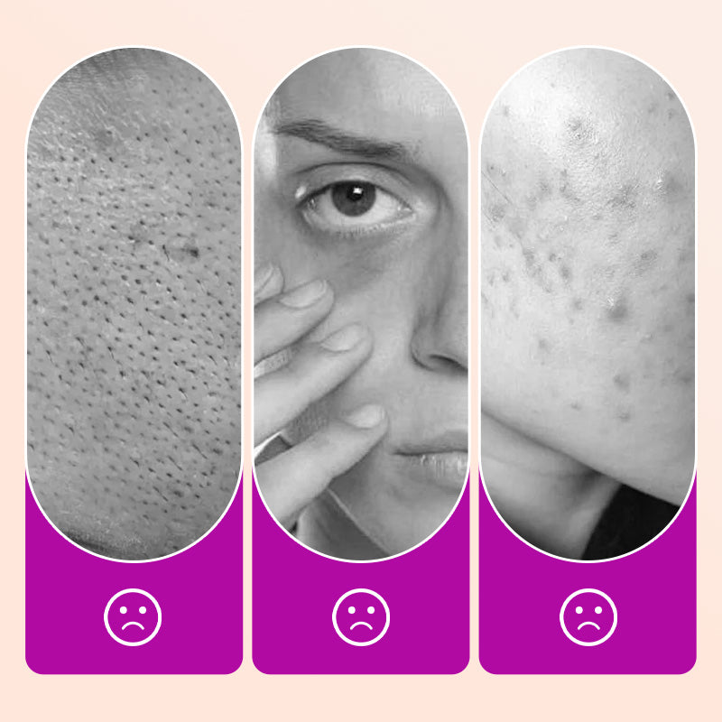 💖 BUY 1 GET 1 FREE! ✨ Flawless Brightening Under Eye Concealer – Full Coverage, Radiant Finish & Long-Lasting Wear 👁️