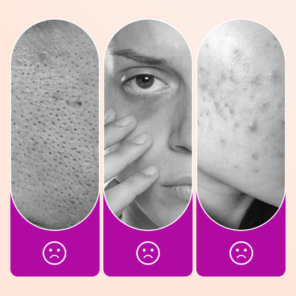 💖 BUY 1 GET 1 FREE! ✨ Flawless Brightening Under Eye Concealer – Full Coverage, Radiant Finish & Long-Lasting Wear 👁️